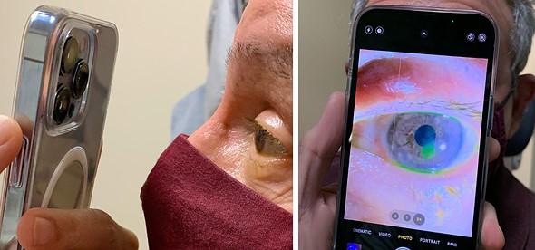 Dr Korn Eye Care iPhone 131